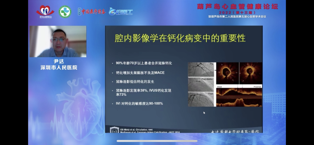 葫蘆島心血管健康論壇?2022｜創(chuàng)新驅(qū)動發(fā)展，不斷提升心血管疾病救治能力(圖11)