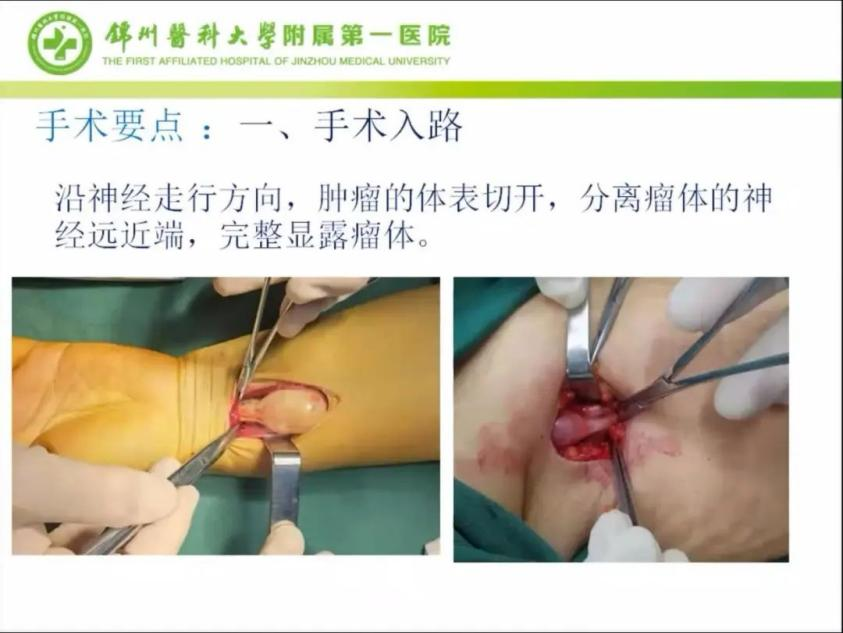 聚焦顯微外科|葫蘆島市醫(yī)學會顯微外科學分會第一屆第二次學術(shù)會議順利召開(圖13) 聚焦顯微外科|葫蘆島市醫(yī)學會顯微外科學分會第一屆第二次學術(shù)會議順利召開(圖13)